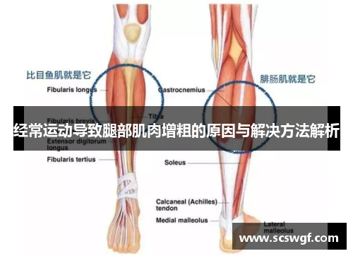 经常运动导致腿部肌肉增粗的原因与解决方法解析